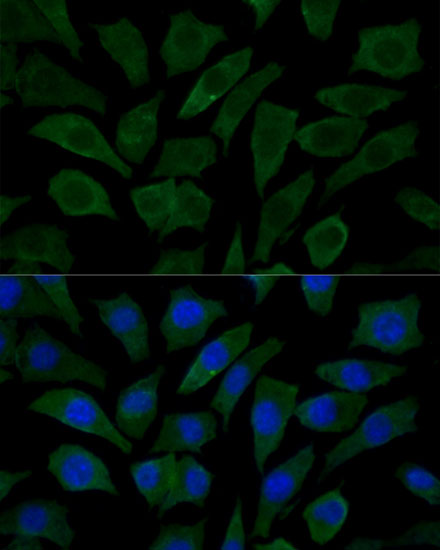 Immunofluorescence analysis of L929 cells using COX15 Polyclonal Antibody at dilution of  1:100 (40x lens). Blue: DAPI for nuclear staining.