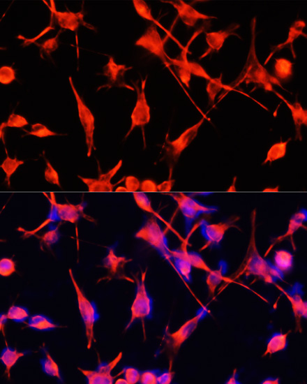 Immunofluorescence analysis of U-251MG cells using GFAP Polyclonal Antibody at dilution of  1:100. Blue: DAPI for nuclear staining.