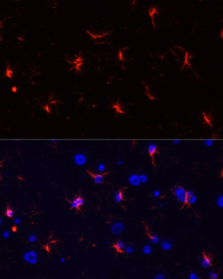 Immunofluorescence analysis of Rat brain using GFAP Polyclonal Antibody at dilution of  1:100. Blue: DAPI for nuclear staining.