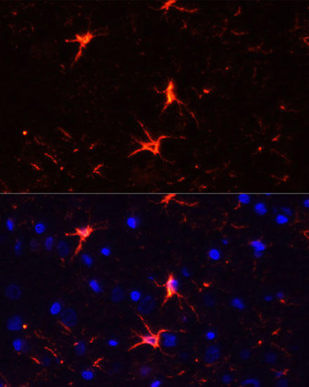 Immunofluorescence analysis of Mouse brain using GFAP Polyclonal Antibody at dilution of  1:100. Blue: DAPI for nuclear staining.