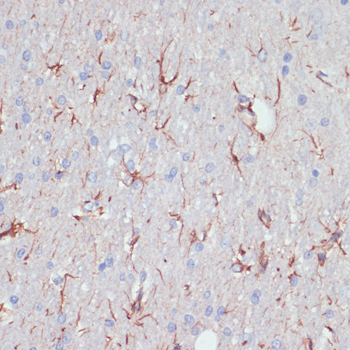 Immunohistochemistry of paraffin-embedded Rat brain using GFAP Polyclonal Antibody at dilution of  1:200 (40x lens).