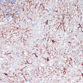 Immunohistochemistry of paraffin-embedded Rat cerebellum using GFAP Polyclonal Antibody at dilution of  1:100 (40x lens).