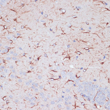 Immunohistochemistry of paraffin-embedded Mouse brain using GFAP Polyclonal Antibody at dilution of  1:100 (40x lens).