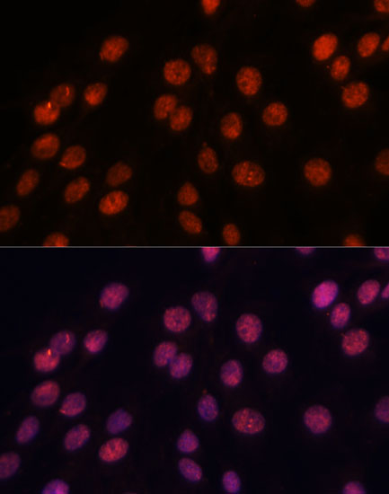 Immunofluorescence analysis of C6 cells using IPO8 Polyclonal Antibody at dilution of  1:100. Blue: DAPI for nuclear staining.