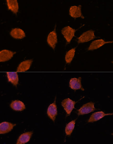 Immunofluorescence analysis of L929 cells using IPO8 Polyclonal Antibody at dilution of  1:100. Blue: DAPI for nuclear staining.