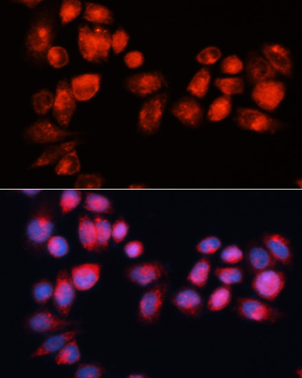 Immunofluorescence analysis of HeLa cells using ABCB7 Polyclonal Antibody at dilution of  1:100 (40x lens). Blue: DAPI for nuclear staining.