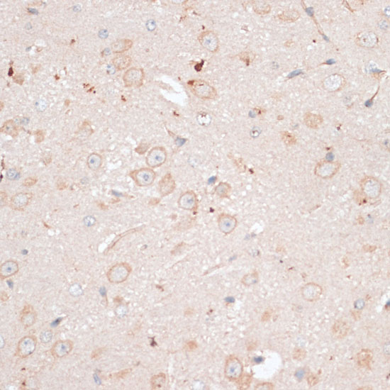 Immunohistochemistry of paraffin-embedded Mouse brain using ABCB7 Polyclonal Antibody at dilution of  1:100 (40x lens).
