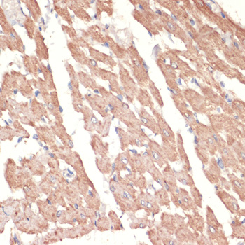 Immunohistochemistry of paraffin-embedded Rat heart using ADRA1A Polyclonal Antibody at dilution of  1:100 (40x lens).