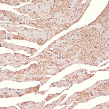 Immunohistochemistry of paraffin-embedded Mouse heart using ADRA1A Polyclonal Antibody at dilution of  1:100 (40x lens).