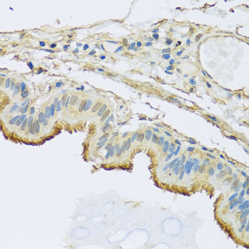 Immunohistochemistry of paraffin-embedded Human trachea using NDUFB5 Polyclonal Antibody at dilution of  1:100 (40x lens).