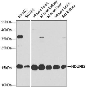 Western blot analysis of extracts of various cell lines using NDUFB5 Polyclonal Antibody at dilution of 1:1000.