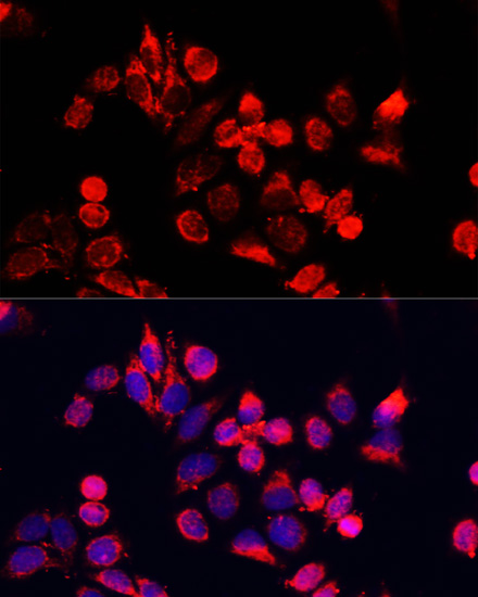 Immunofluorescence analysis of HeLa cells using NFE2L1 Polyclonal Antibody at dilution of  1:100. Blue: DAPI for nuclear staining.