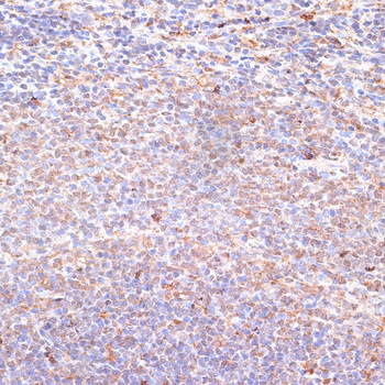 Immunohistochemistry of paraffin-embedded Rat spleen using NFE2L1 Polyclonal Antibody at dilution of  1:100 (40x lens).