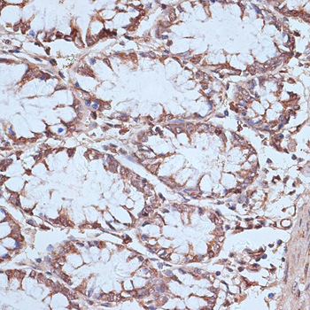 Immunohistochemistry of paraffin-embedded Human colon using NFE2L1 Polyclonal Antibody at dilution of  1:100 (40x lens).