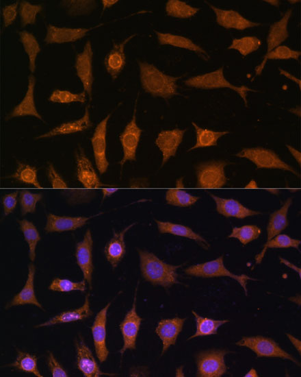 Immunofluorescence analysis of L929 cells using PDE6D Polyclonal Antibody at dilution of  1:100 (40x lens). Blue: DAPI for nuclear staining.