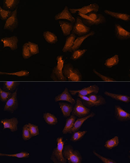 Immunofluorescence analysis of U-2 OS cells using PDE6D Polyclonal Antibody at dilution of  1:100 (40x lens). Blue: DAPI for nuclear staining.