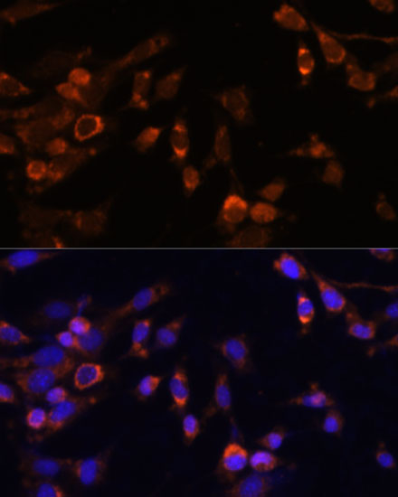 Immunofluorescence analysis of NIH-3T3 cells using PSMB7 Polyclonal Antibody at dilution of  1:100 (40x lens). Blue: DAPI for nuclear staining.