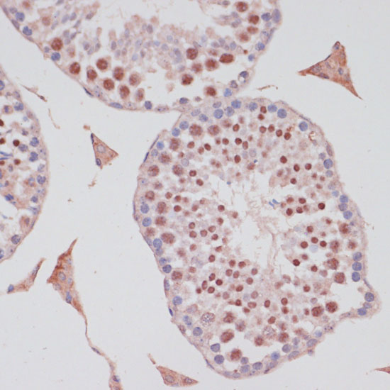 Immunohistochemistry of paraffin-embedded Mouse testis using S100P Polyclonal Antibody at dilution of  1:100 (40x lens).