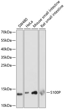 Western blot analysis of extracts of various cell lines using S100P Polyclonal Antibody at dilution of 1:1000.