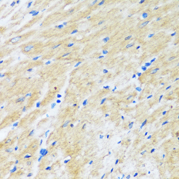 Immunohistochemistry of paraffin-embedded Rat heart using BAG3 Polyclonal Antibody at dilution of  1:100 (40x lens).