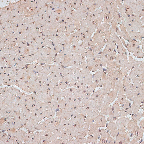 Immunohistochemistry of paraffin-embedded Rat heart using TLK1 Polyclonal Antibody at dilution of  1:100 (40x lens).