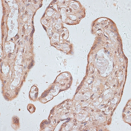 Immunohistochemistry of paraffin-embedded Human placenta using TLK1 Polyclonal Antibody at dilution of  1:100 (40x lens).