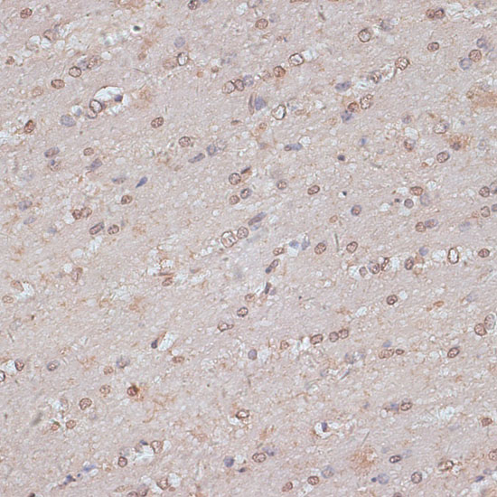 Immunohistochemistry of paraffin-embedded Mouse brain using TLK1 Polyclonal Antibody at dilution of  1:100 (40x lens).