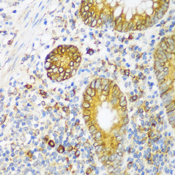 Immunohistochemistry of paraffin-embedded Human appendix using ERLIN1 Polyclonal Antibody at dilution of  1:100 (40x lens).