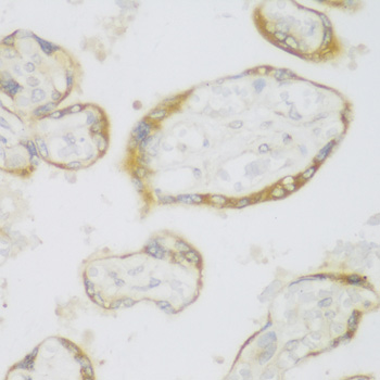 Immunohistochemistry of paraffin-embedded Human placenta using ERLIN1 Polyclonal Antibody at dilution of  1:100 (40x lens).