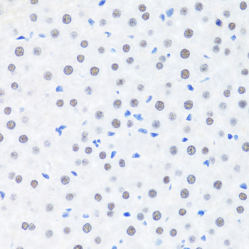 Immunohistochemistry of paraffin-embedded Rat liver using BRMS1 Polyclonal Antibody at dilution of  1:100 (40x lens).