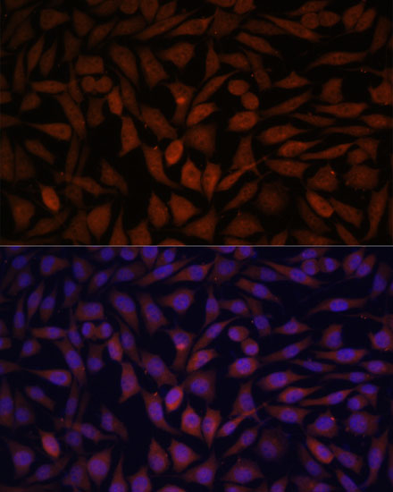 Immunofluorescence analysis of L929 cells using KLHL8 Polyclonal Antibody at dilution of  1:100. Blue: DAPI for nuclear staining.