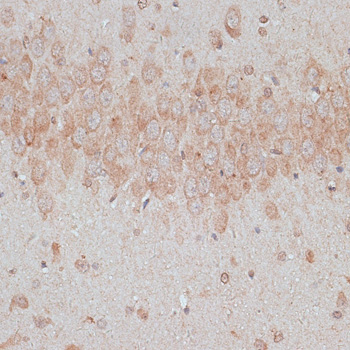 Immunohistochemistry of paraffin-embedded Rat brain using TMX1 Polyclonal Antibody at dilution of  1:100 (40x lens).