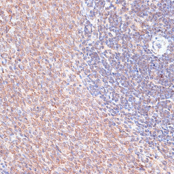 Immunohistochemistry of paraffin-embedded Rat spleen using TMX1 Polyclonal Antibody at dilution of  1:100 (40x lens).