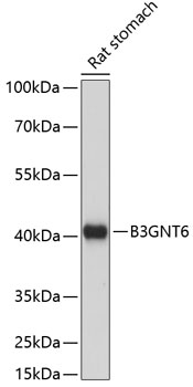 Western blot analysis of extracts of Rat stomach using B3GNT6 Polyclonal Antibody at dilution of 1:1000.