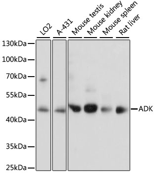 Western blot analysis of extracts of various cell lines using ADK Polyclonal Antibody at dilution of 1:1000.