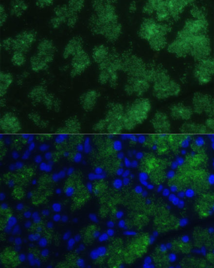 Immunofluorescence analysis of Rat pancreas using CTRB1 Polyclonal Antibody at dilution of  1:100 (40x lens). Blue: DAPI for nuclear staining.