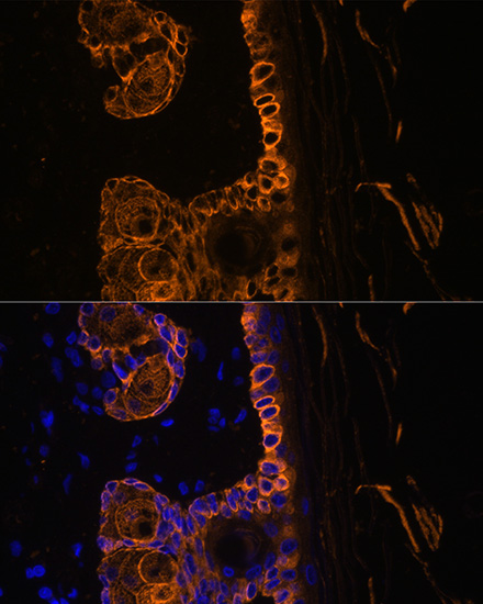 Immunofluorescence analysis of Rat skin using KRT14 Polyclonal Antibody at dilution of  1:100. Blue: DAPI for nuclear staining.