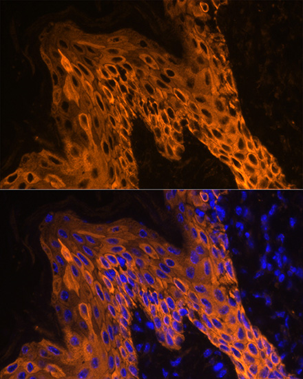 Immunofluorescence analysis of Human skin using KRT14 Polyclonal Antibody at dilution of  1:100. Blue: DAPI for nuclear staining.