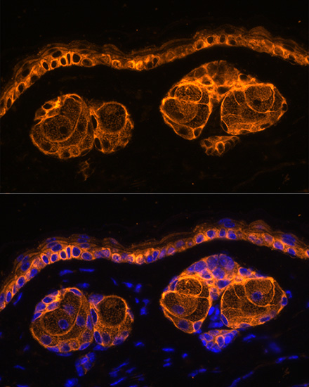 Immunofluorescence analysis of Mouse skin using KRT14 Polyclonal Antibody at dilution of  1:100. Blue: DAPI for nuclear staining.