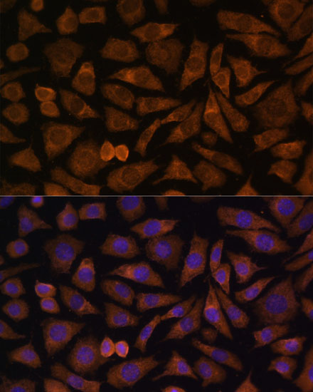 Immunofluorescence analysis of L929 cells using RABIF Polyclonal Antibody at dilution of  1:100 (40x lens). Blue: DAPI for nuclear staining.