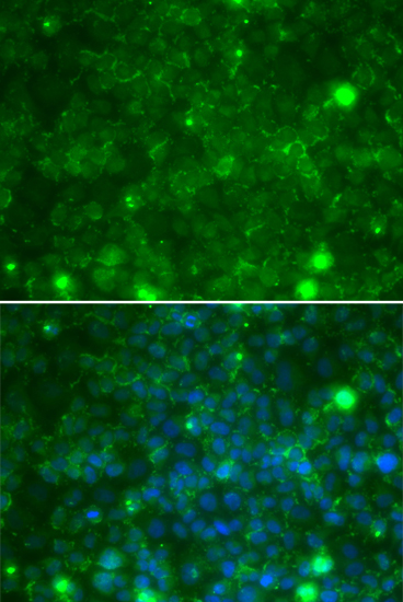Immunofluorescence analysis of MCF-7 cells using TIMP3 Polyclonal Antibody