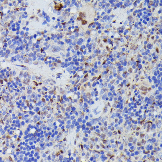 Immunohistochemistry of paraffin-embedded Rat spleen using CDC23 Polyclonal Antibody at dilution of  1:100 (40x lens).