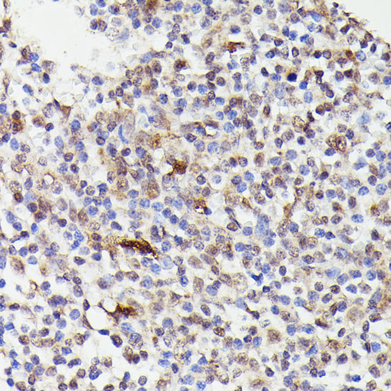 Immunohistochemistry of paraffin-embedded Human tonsil using CDC23 Polyclonal Antibody at dilution of  1:100 (40x lens).