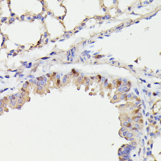 Immunohistochemistry of paraffin-embedded Mouse lung using CDC23 Polyclonal Antibody at dilution of  1:100 (40x lens).