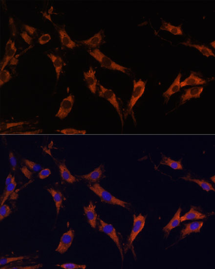 Immunofluorescence analysis of C6 cells using KSR1 Polyclonal Antibody at dilution of  1:100 (40x lens). Blue: DAPI for nuclear staining.