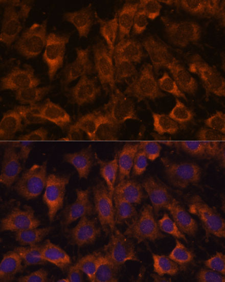 Immunofluorescence analysis of C6 cells using SEC23B Polyclonal Antibody at dilution of  1:100. Blue: DAPI for nuclear staining.