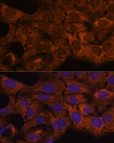 Immunofluorescence analysis of U-2 OS cells using SEC23B Polyclonal Antibody at dilution of  1:100. Blue: DAPI for nuclear staining.