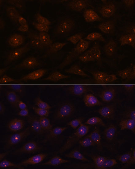 Immunofluorescence analysis of C6 cells using RNASEH2A Polyclonal Antibody at dilution of  1:100. Blue: DAPI for nuclear staining.