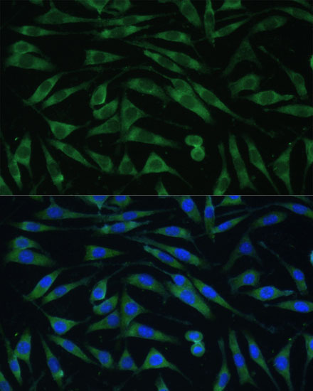Immunofluorescence analysis of L929 cells using DNM3 Polyclonal Antibody at dilution of  1:100 (40x lens). Blue: DAPI for nuclear staining.
