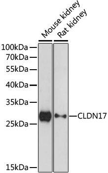 Western blot analysis of extracts of various cell lines using CLDN17 Polyclonal Antibody at dilution of 1:1000.